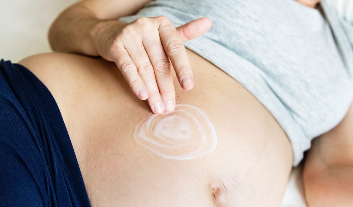 Prevention of Stretch Marks During Pregnancy