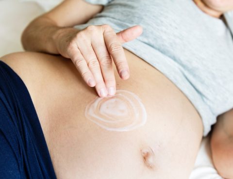 Prevention of Stretch Marks During Pregnancy