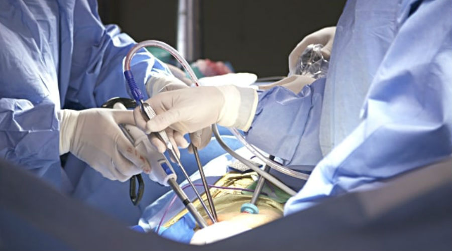 minimally invasive laparoscopic hysterectomy in los angeles glendale