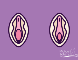 Facts And Myths About A Loose Vagina (1)