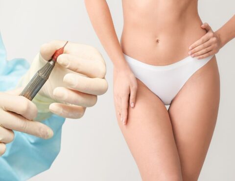 What is Non Surgical Labiaplasty
