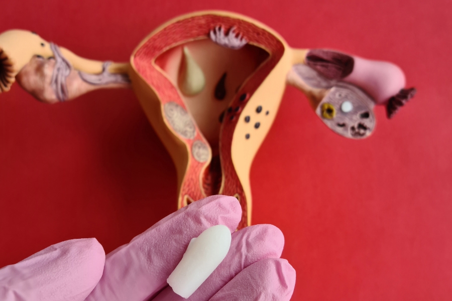 Vaginal Probiotic suppositories for insertion